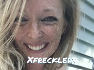 Xfreckledx